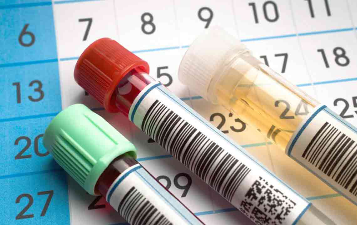 Proven Methods to Reduce Uric Acid Levels Naturally
