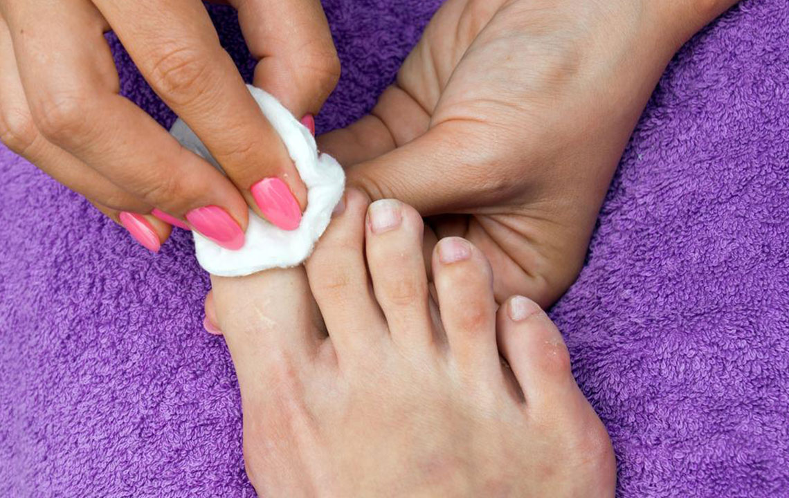 Effective Strategies for Eliminating Nail Fungal Infections