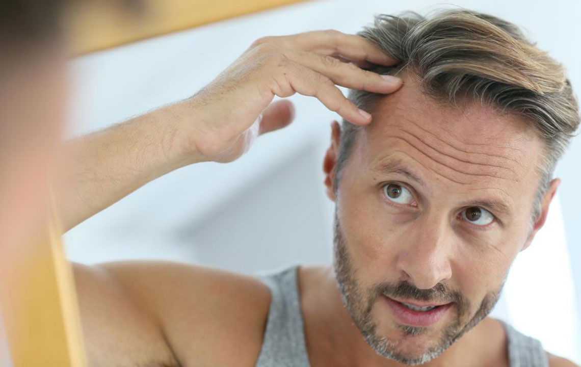 Understanding Hair Loss: Causes and Solutions
