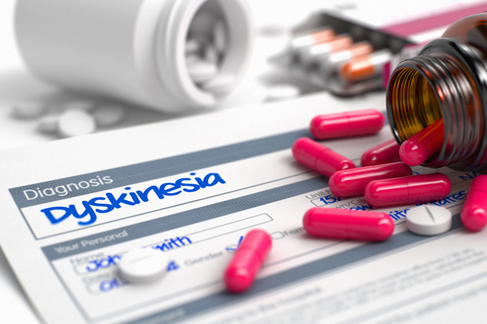 Managing Dyskinesia: Treatment Strategies and Care Approaches