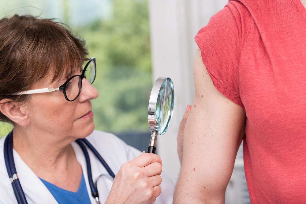 Comprehensive Guide to Eczema: Types, Symptoms, and Effective Treatments