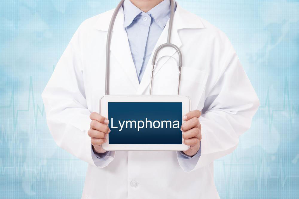 Assessing Prognosis and Survival Rates in B-Cell Lymphoma Patients