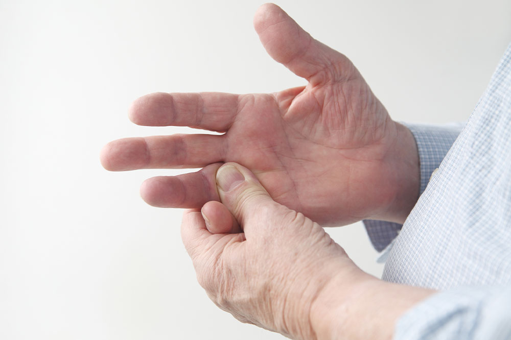Effective Strategies for Preventing and Managing Rheumatoid Arthritis