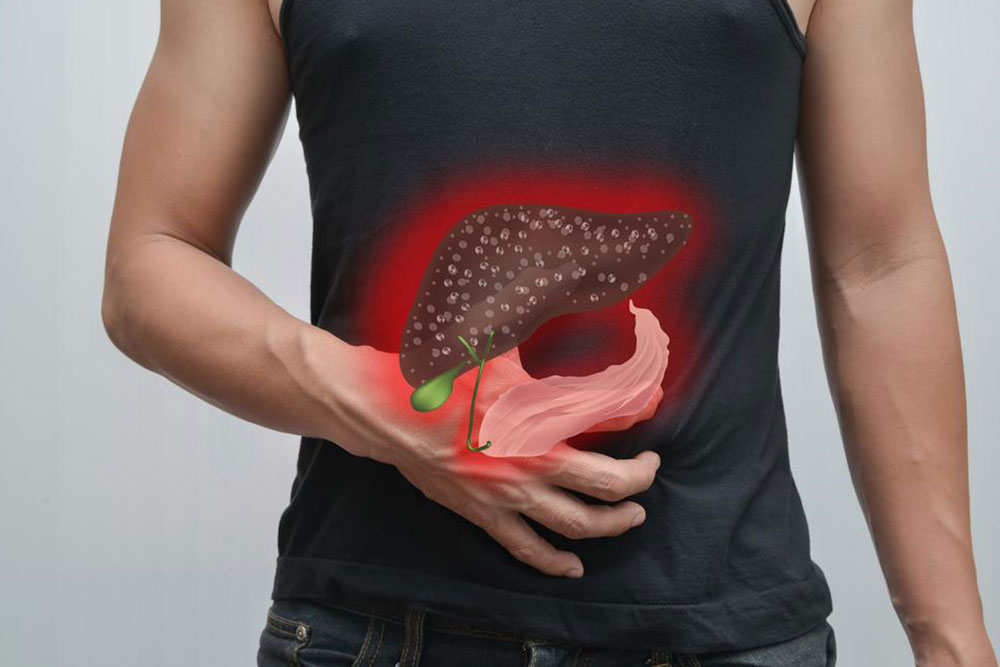 Tips for Maintaining a Healthy Gallbladder