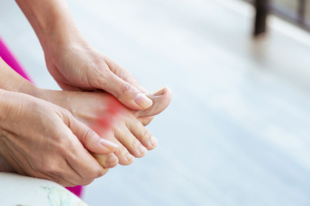 Comprehensive Guide to Gout: How to Detect, Manage, and Prevent This Common Joint Disorder