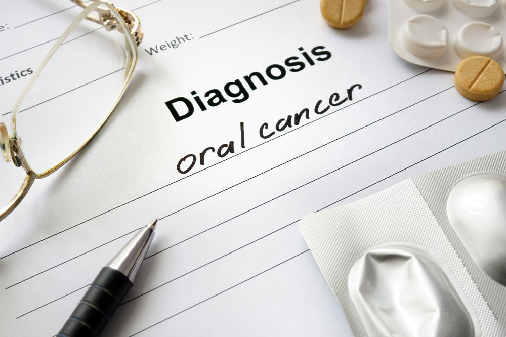 Early Detection and Management of Mouth Cancer: Symptoms and Prevention Tips