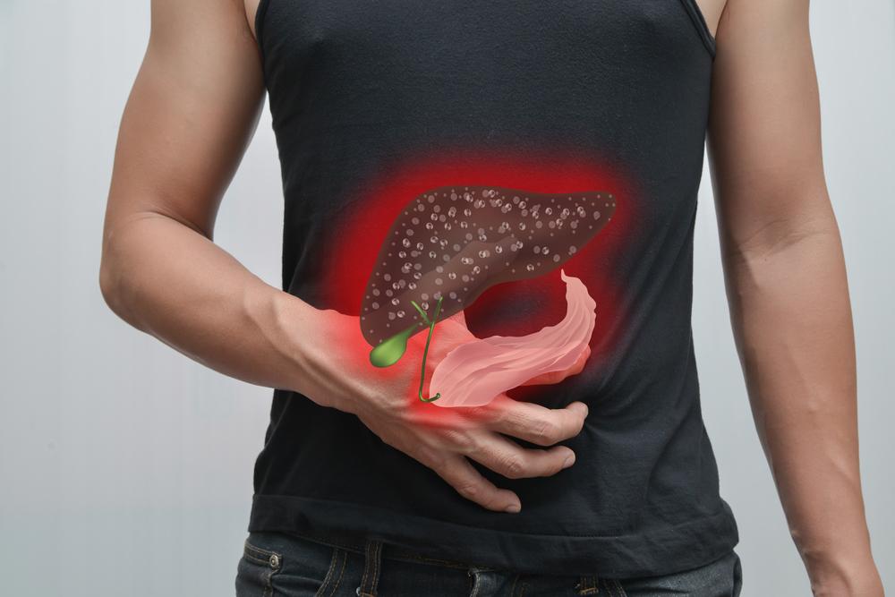 Understanding Liver Cancer: Causes, Signs, Diagnostics, Treatments, and Prevention Strategies