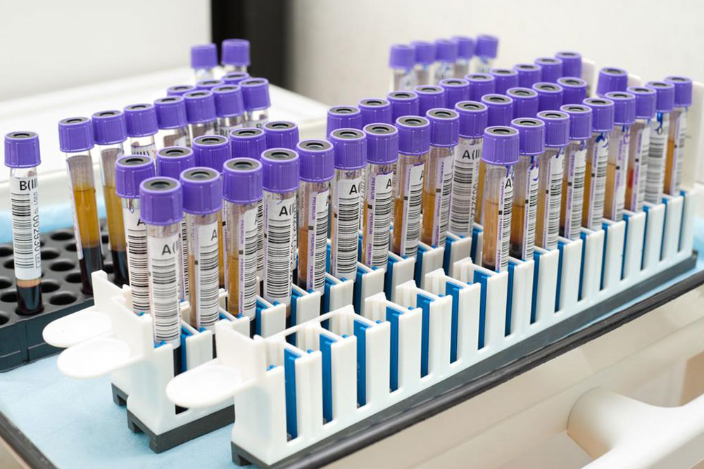 Understanding Age-Adjusted PSA Levels for Prostate Health
