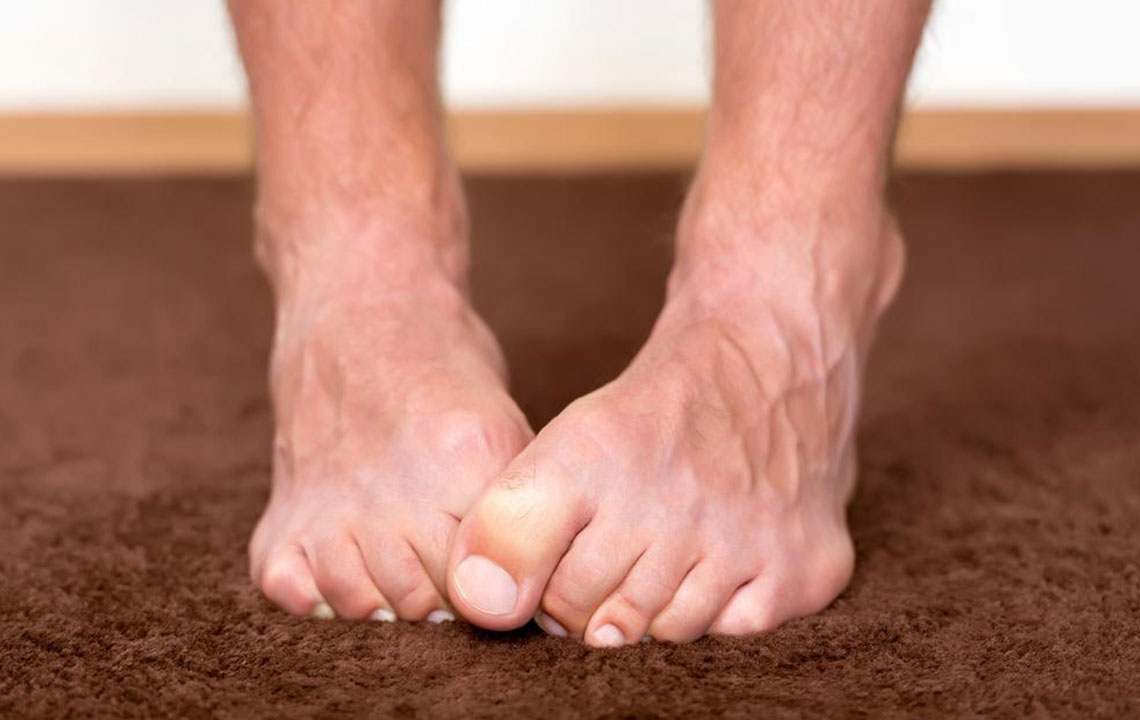 Understanding Foot Neuropathy: Symptoms, Causes, and Management Strategies