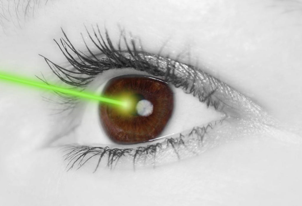 Understanding LASIK Eye Surgery: Costs and Benefits