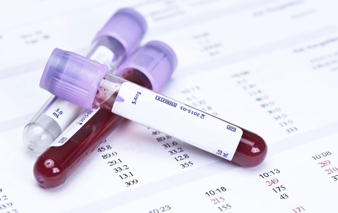 Understanding and Monitoring Blood Glucose Charts