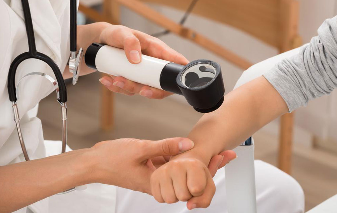 Effective Strategies for Managing Eczema Symptoms