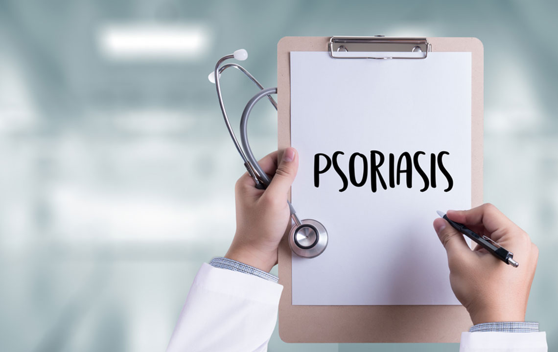 Effective Strategies and Treatments for Managing Psoriasis