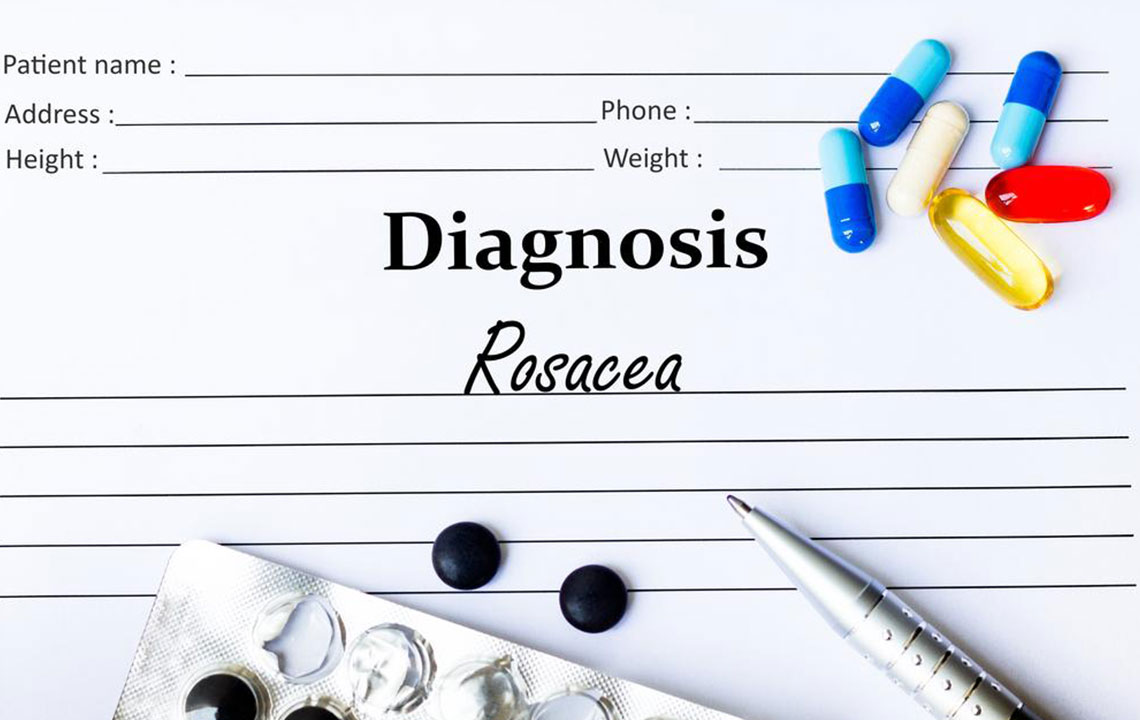 Top Strategies for Managing Rosacea Effectively