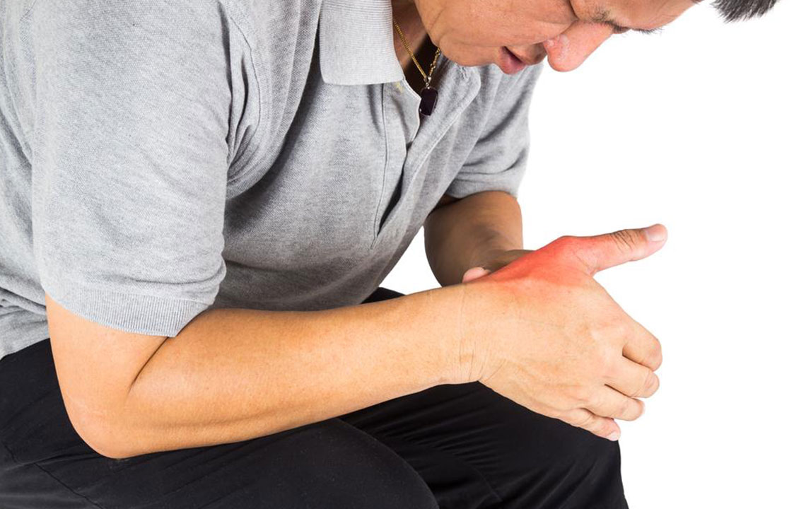 Understanding Causes and Remedies for Swollen Fingers