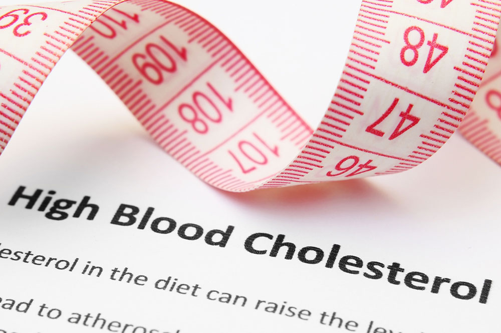 Understanding High Cholesterol: Symptoms, Causes, and Risks