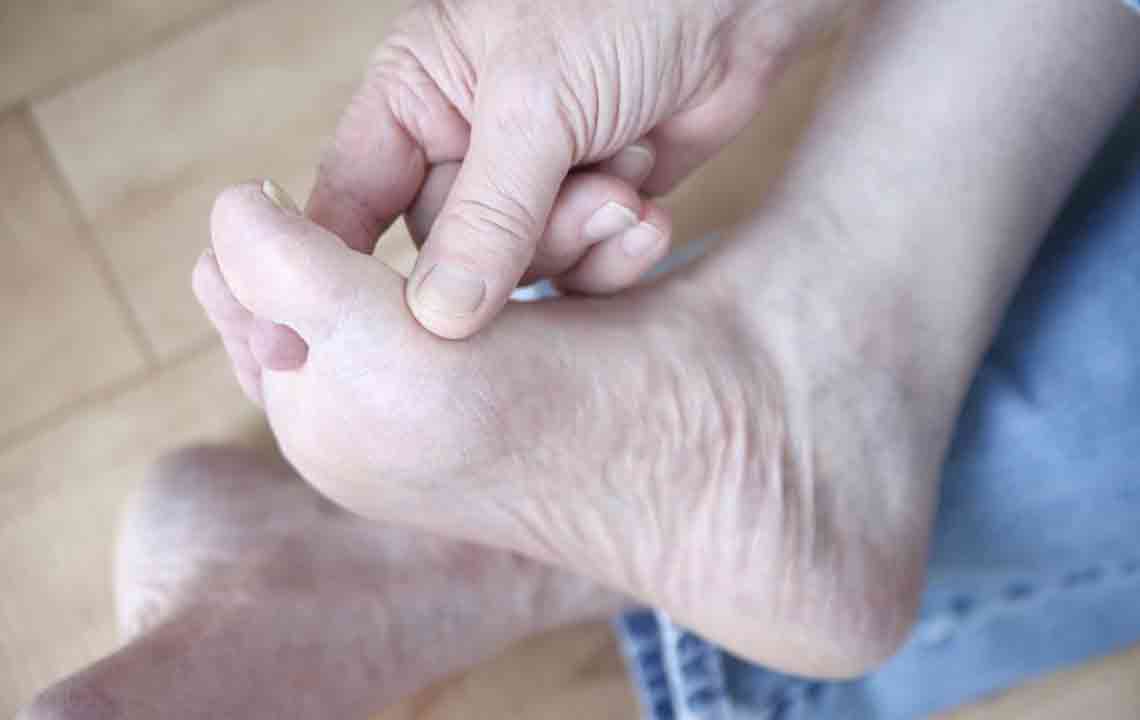 Effective Strategies to Alleviate Gout-Related Foot Discomfort