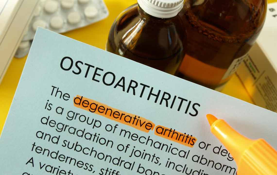 Understanding Knee Osteoarthritis: Causes, Symptoms, and Management Strategies