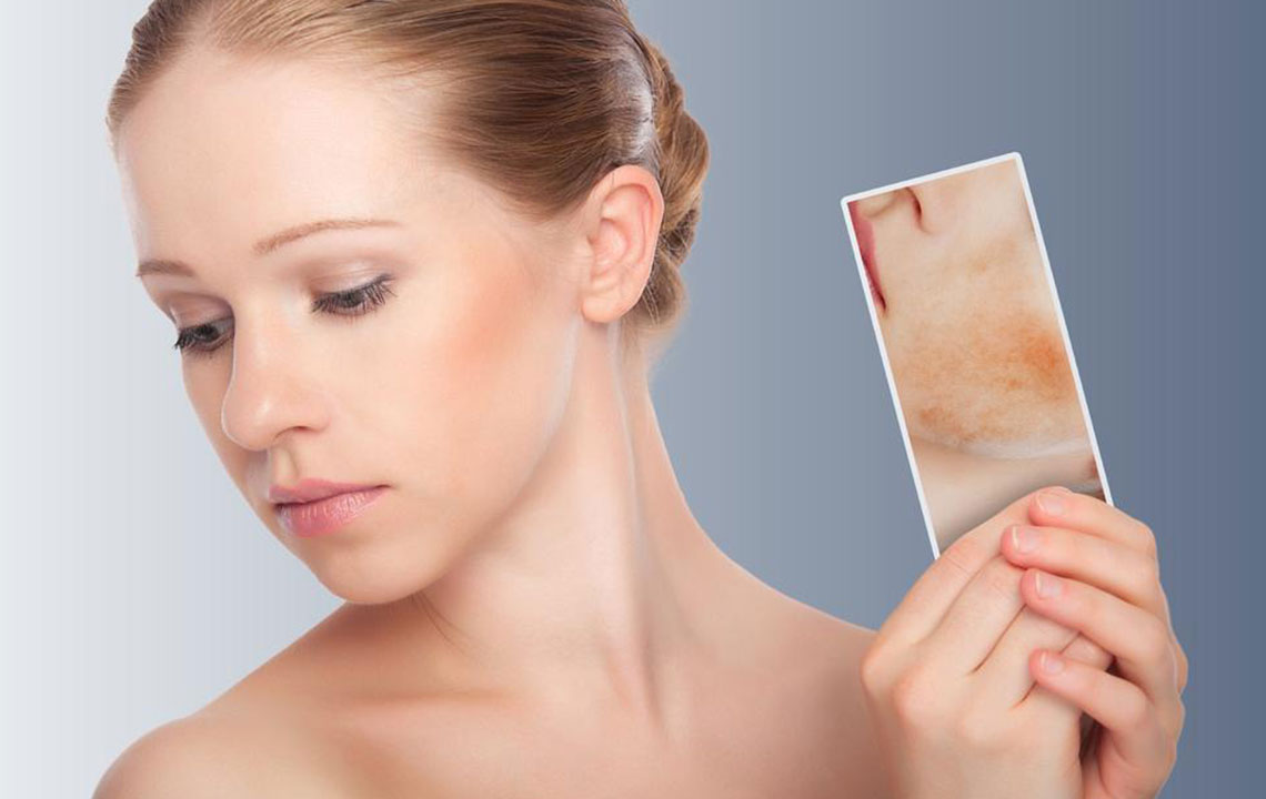 Comprehensive Guide to Managing Skin Rashes: Essential Do's and Don'ts