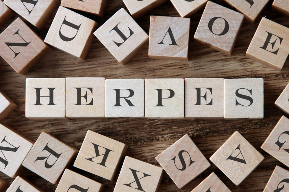 Comprehensive Guide to Herpes: Causes, Types, and Transmission