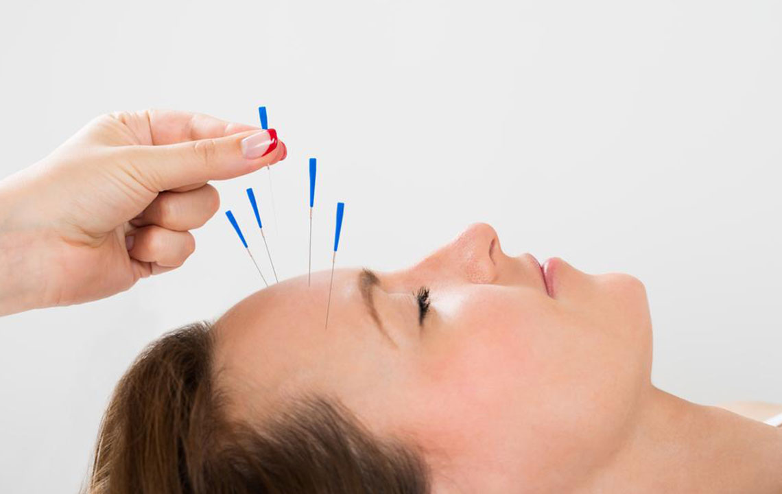 Top Strategies for Relieving Nerve Discomfort