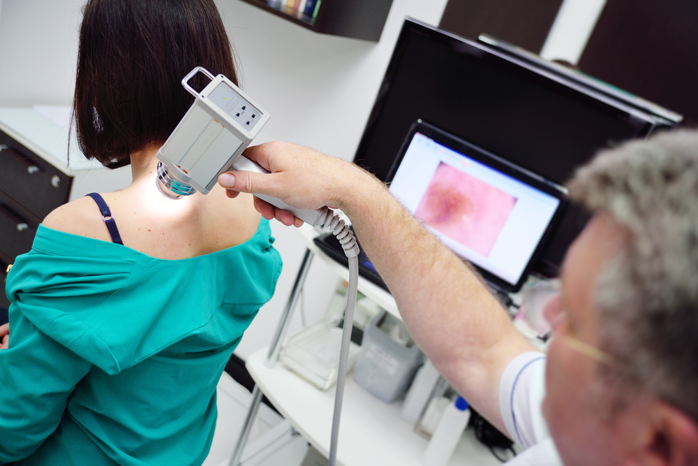 Understanding Skin Growths: Essential FAQs About Seborrheic Keratosis