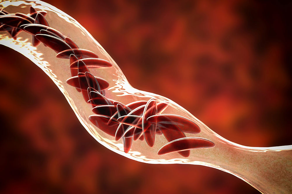 Comprehensive Guide to Hematological Disorders: Causes, Symptoms, and Modern Treatments