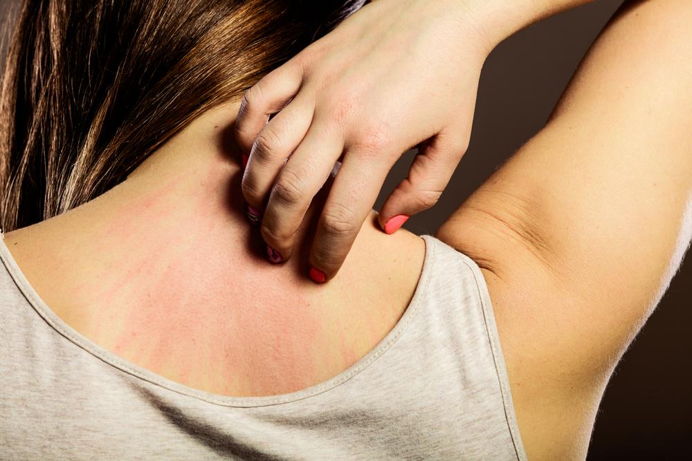Understanding Eczema: Types and Key Facts