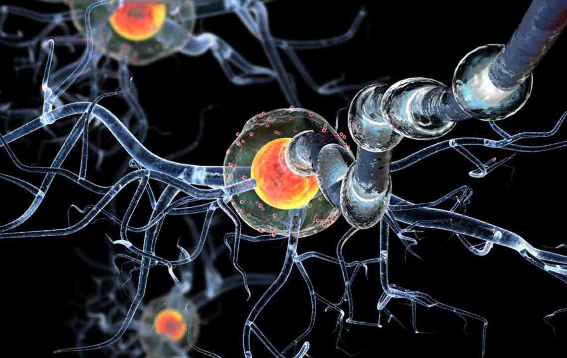Understanding Huntington's Disease: Key Facts and Insights