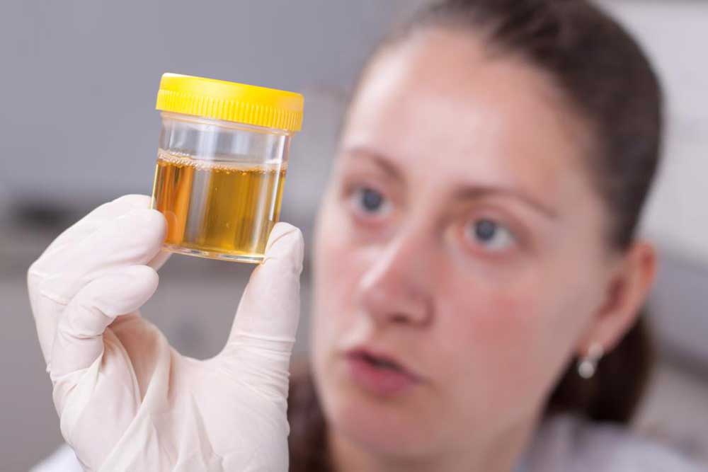 Using a Urine Color Chart to Assess Your Health Status