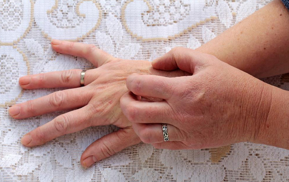 Comprehensive Guide to Common Skin Rashes: Causes, Symptoms, and Recognition