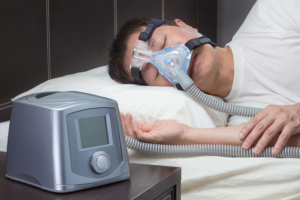Key Insights into Sleep Apnea: Causes, Symptoms, and Treatment