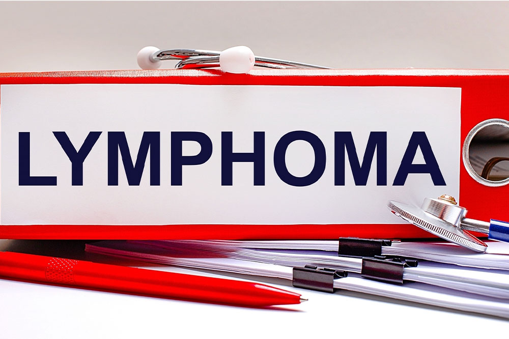 Comprehensive Guide to B-Cell Follicular Lymphoma