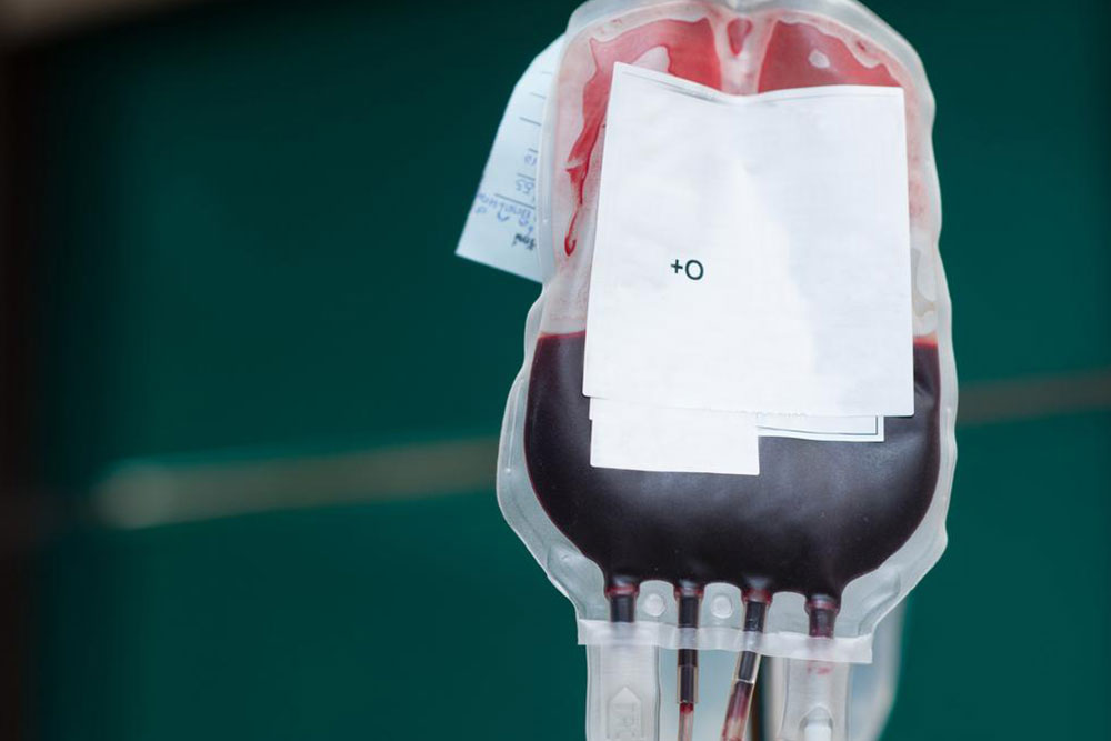Understanding Public Cord Blood Banking and Its Benefits