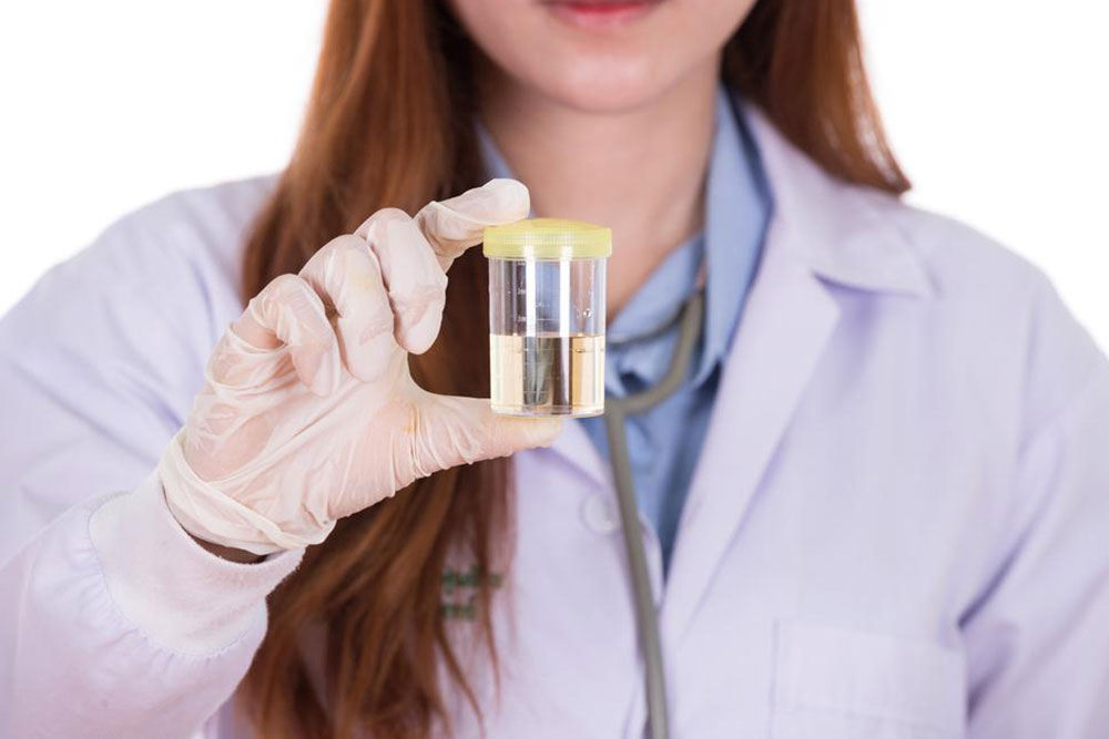 Understanding Urinary E. coli Infections: Causes, Symptoms, and Treatment