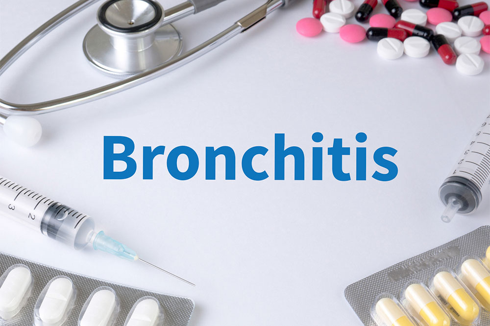 Comprehensive Guide to Managing and Treating Bronchitis Effectively