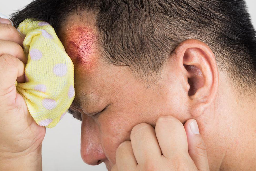 Recognizing and Preventing Concussions: Key Warning Signs