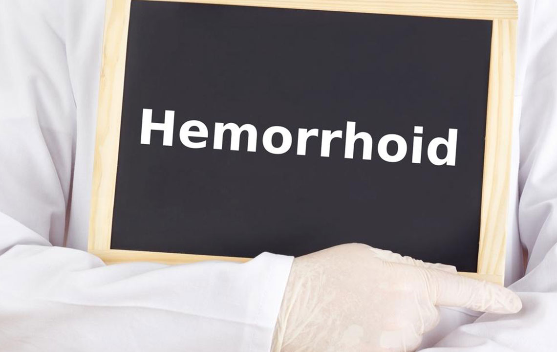 Effective Strategies to Relieve Hemorrhoid Discomfort