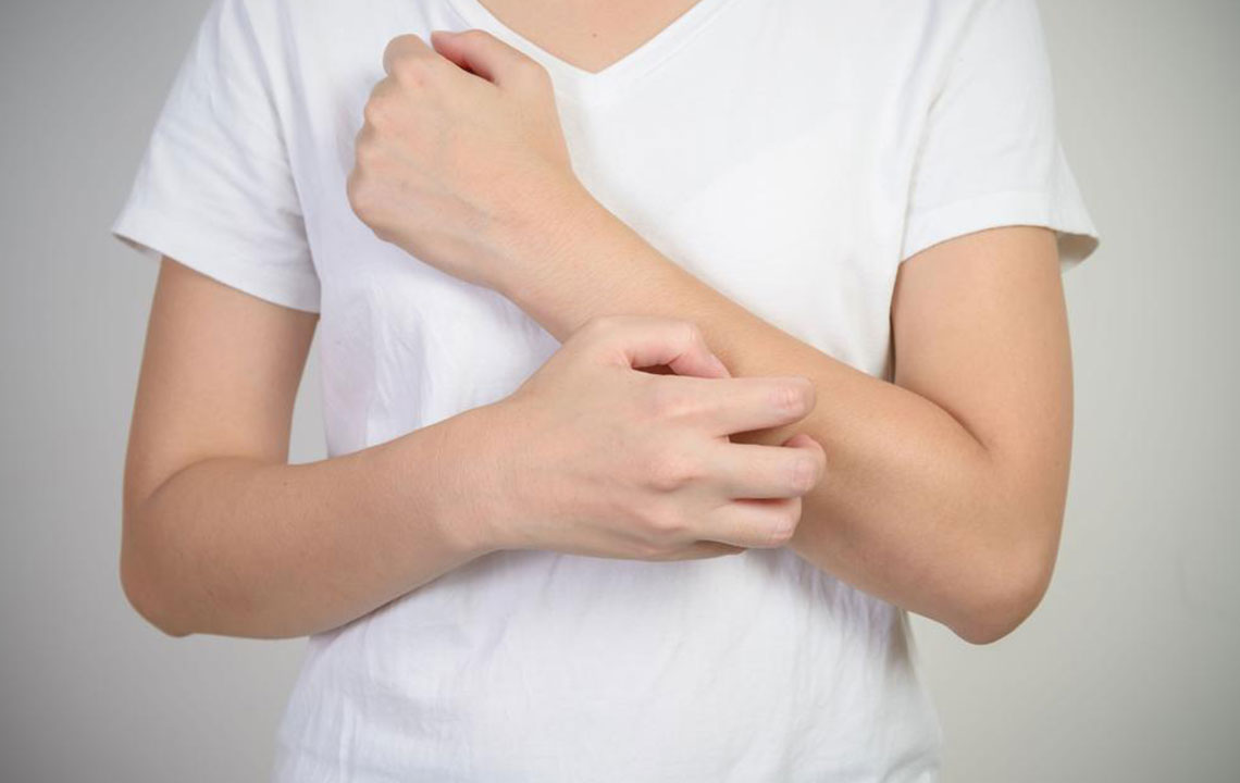 Top 6 Effective Creams for Managing Eczema Symptoms