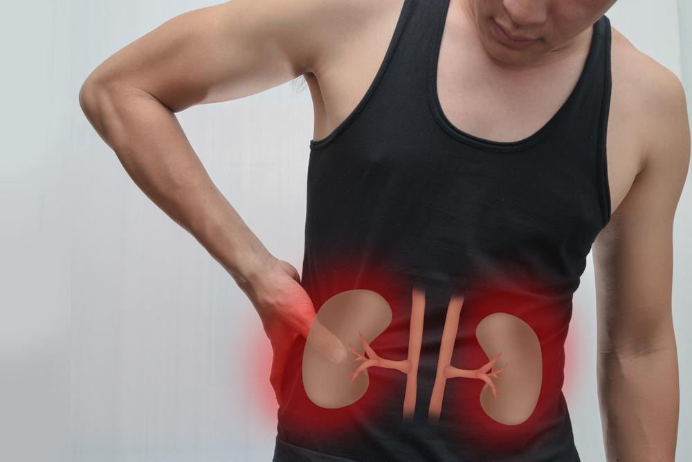 Comprehensive Guide to Managing Kidney Pain Causes and Treatments