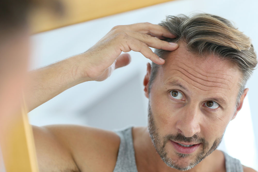Top Natural Remedies to Halt Hair Loss Effectively