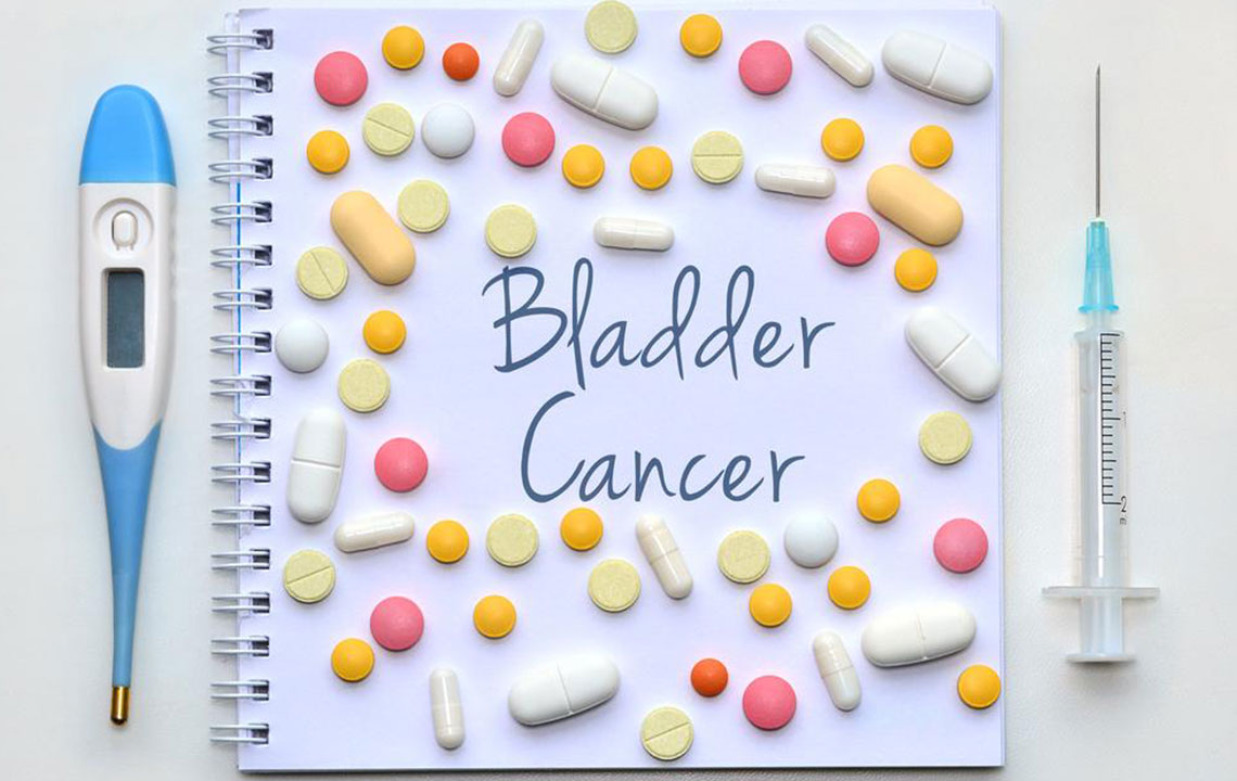 Understanding the Stages of Bladder Cancer: What You Need to Know