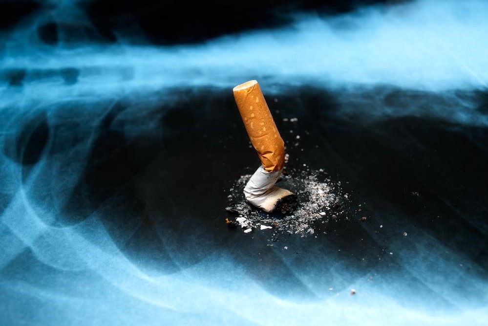Understanding the Major Factors Contributing to Lung Cancer Risk