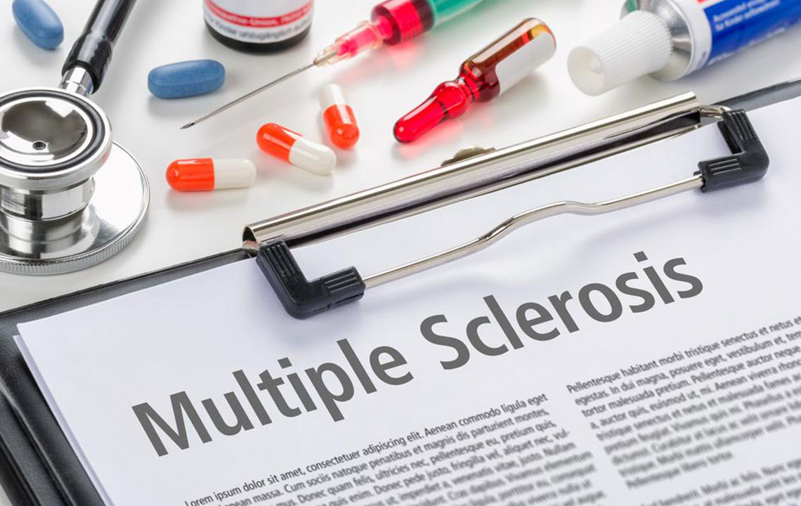 Early Signs and Symptoms of Multiple Sclerosis: A Comprehensive Guide