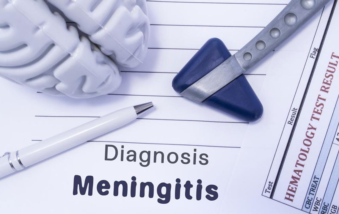 Understanding Streptococcal Meningitis: Causes, Symptoms, and Prevention