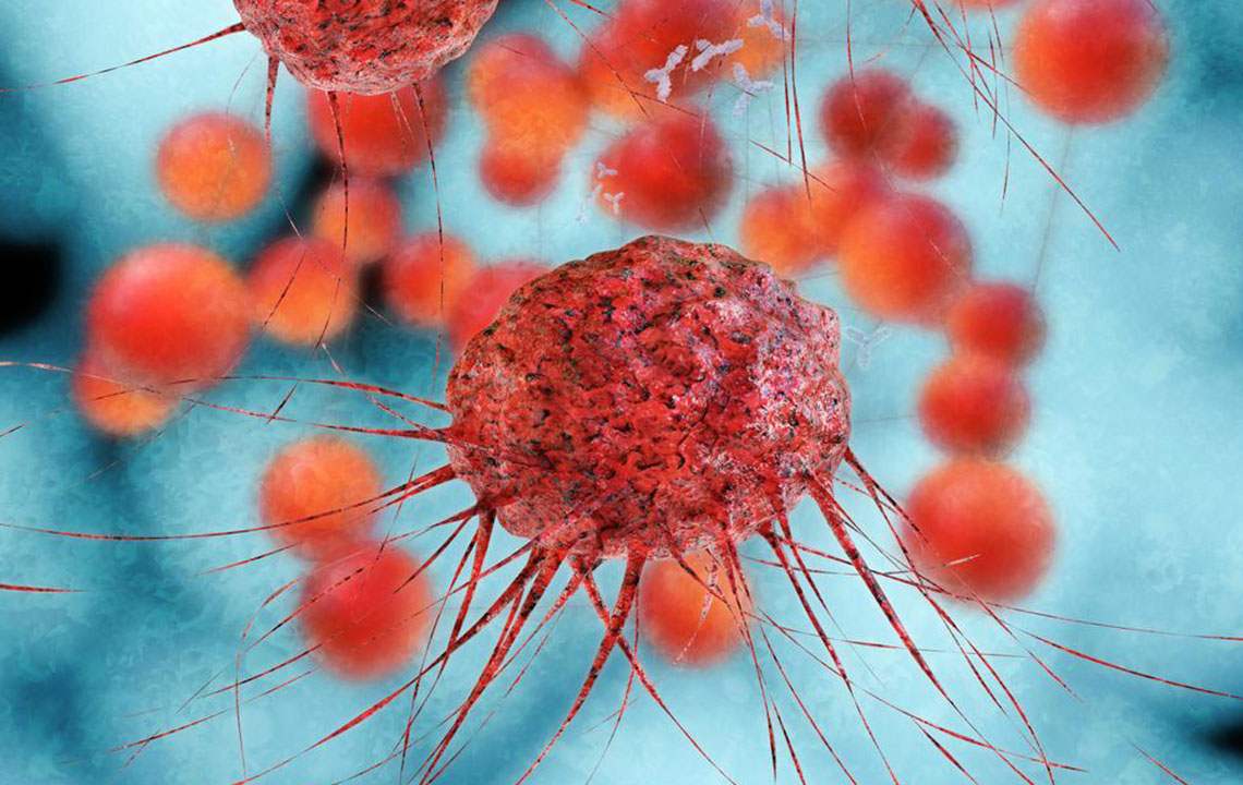 Recognizing Indicators and Symptoms of Advanced Breast Cancer