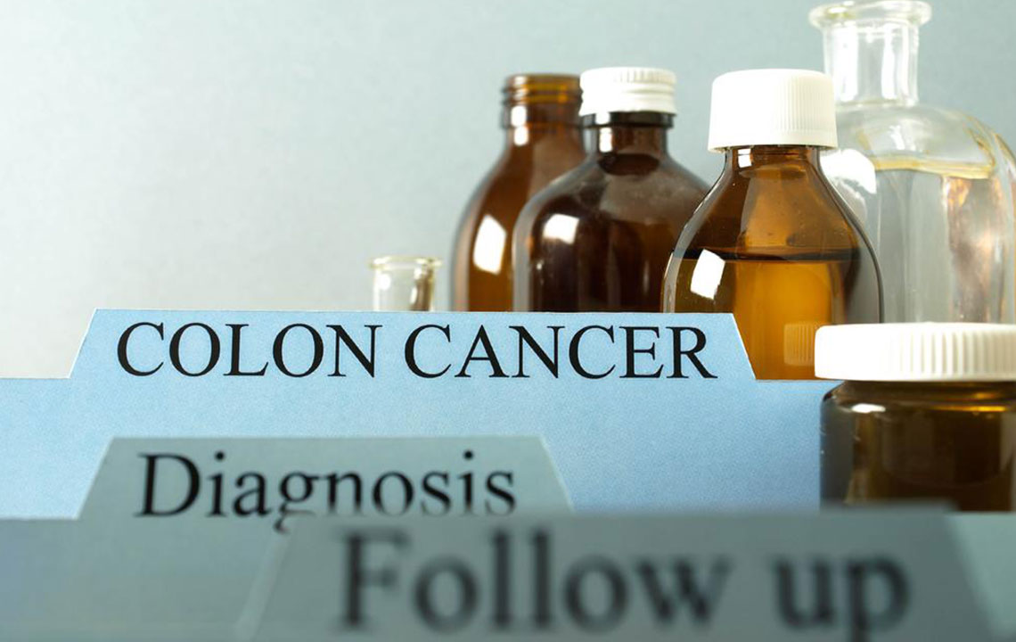 Comprehensive Guide to Colon Cancer: Prevention Strategies and Advanced Treatments