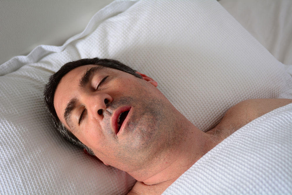 Effective Strategies to Reduce Sleep Snoring