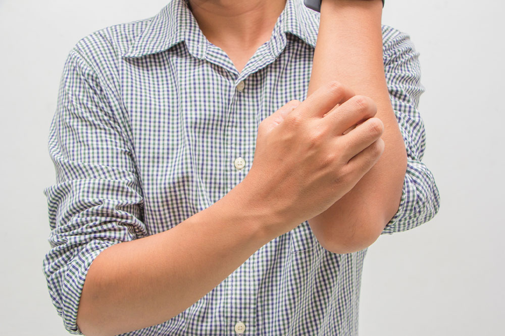 Comprehensive Guide to Jock Itch: Recognizing Symptoms, Causes, and Effective Prevention and Treatment Strategies