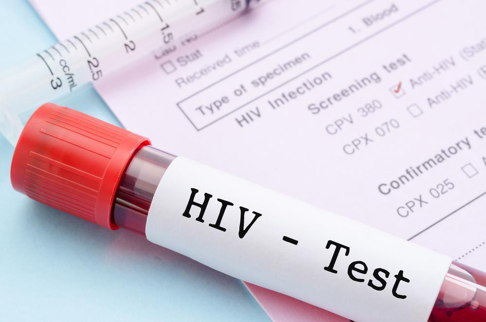 Recognizing the Early Indicators of HIV Infection
